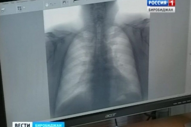 &quotЛидерство&quot по числу туберкулезников среди районов ЕАО досталось Облученскому ГТРК &quotБира&quot